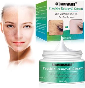 Segminismart-Freckle-Removal-Cream